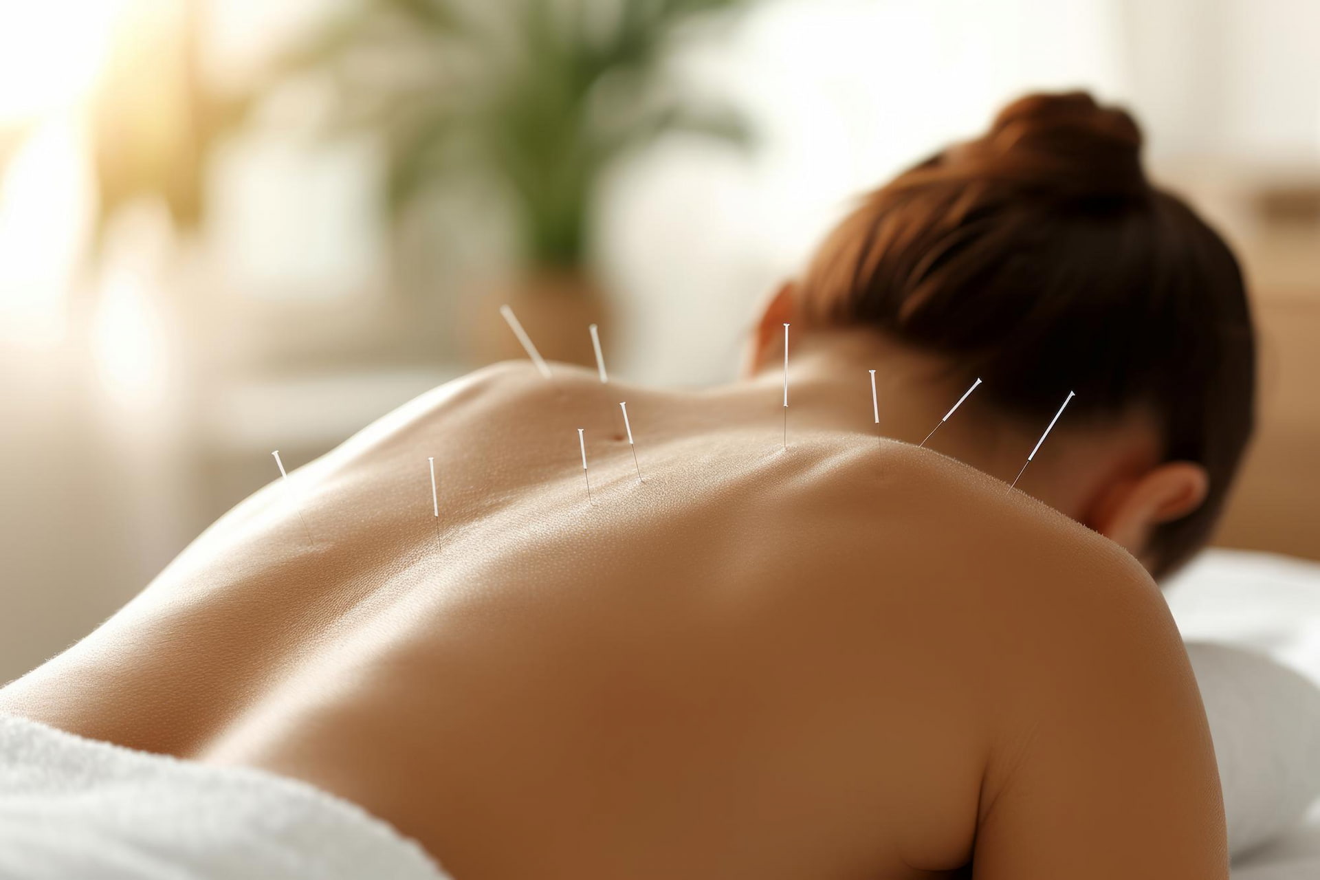 Acupuncture in Somerset NJ