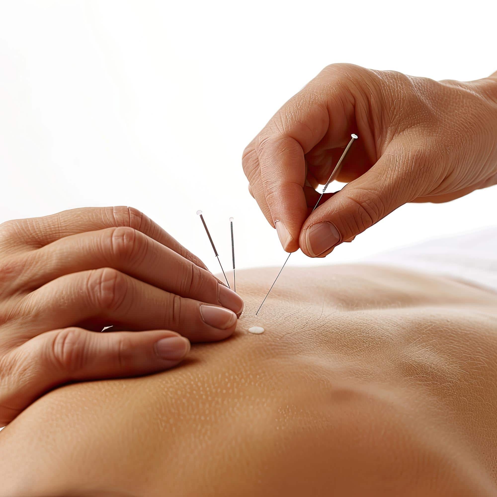 Physical Therapy in Plainfield