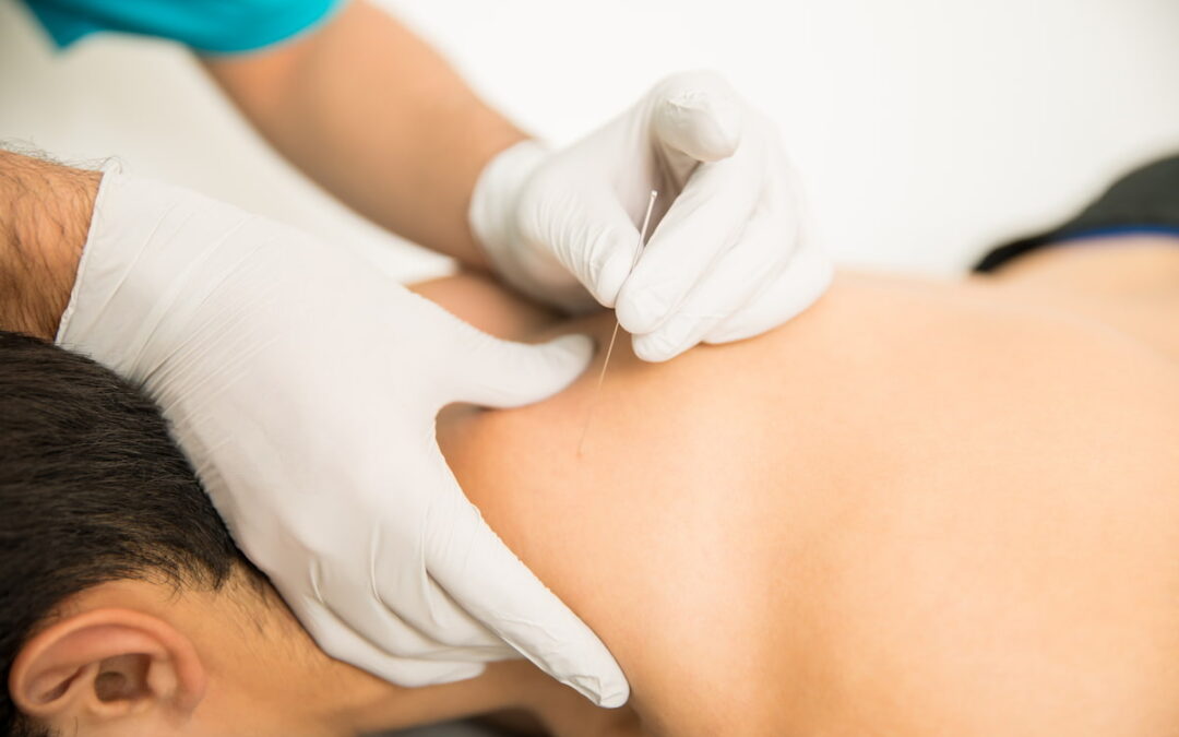 Professional Acupuncture Treatment