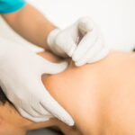 Professional Acupuncture Treatment