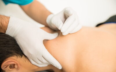 What to Expect from Professional Acupuncture Treatment at Peak Wellness Center