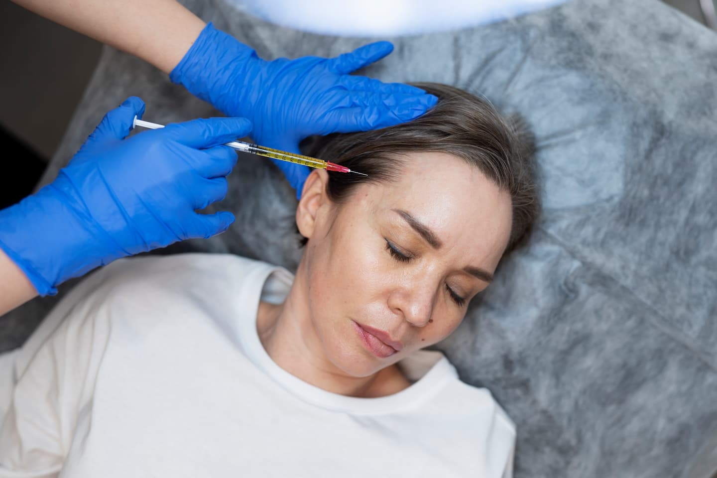 top-view-woman-getting-prp-treatment (1)